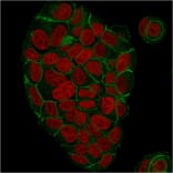 Immunofluorescence - Anti-gamma Catenin Antibody [CTNG/1664] - BSA and Azide free (A252278) - Antibodies.com