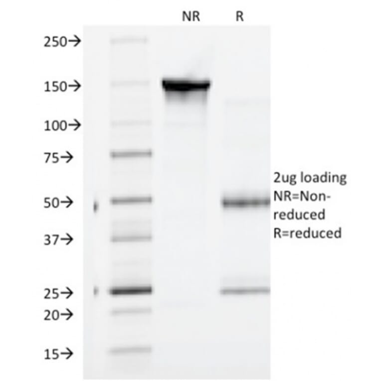 SDS-PAGE - Anti-gamma Catenin Antibody [CTNG/1664] - BSA and Azide free (A252279) - Antibodies.com