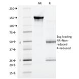 SDS-PAGE - Anti-gamma Catenin Antibody [CTNG/1664] - BSA and Azide free (A252279) - Antibodies.com