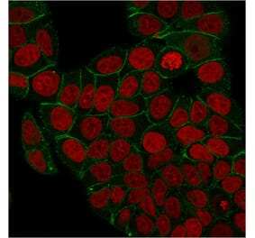 Immunofluorescence - Anti-gamma Catenin Antibody [rCTNG/1664] - BSA and Azide free (A252280) - Antibodies.com