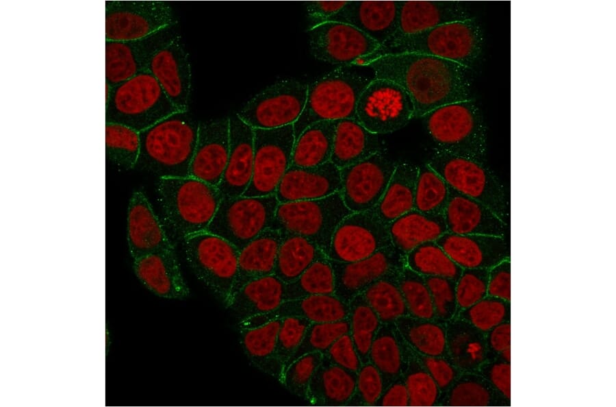 Immunofluorescence - Anti-gamma Catenin Antibody [rCTNG/1664] - BSA and Azide free (A252280) - Antibodies.com