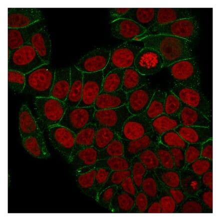 Immunofluorescence - Anti-gamma Catenin Antibody [rCTNG/1664] - BSA and Azide free (A252280) - Antibodies.com