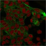 Immunofluorescence - Anti-gamma Catenin Antibody [rCTNG/1664] - BSA and Azide free (A252280) - Antibodies.com