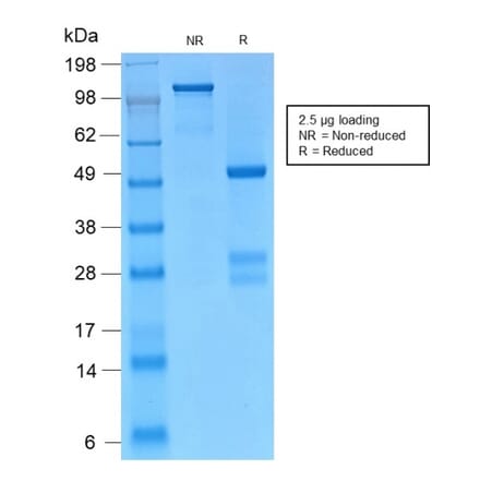 SDS-PAGE - Anti-gamma Catenin Antibody [CTNG/2155R] - BSA and Azide free (A252280) - Antibodies.com