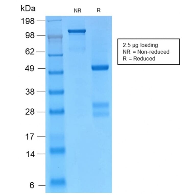 SDS-PAGE - Anti-gamma Catenin Antibody [CTNG/2155R] - BSA and Azide free (A252280) - Antibodies.com