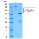 SDS-PAGE - Anti-gamma Catenin Antibody [CTNG/2155R] - BSA and Azide free (A252280) - Antibodies.com