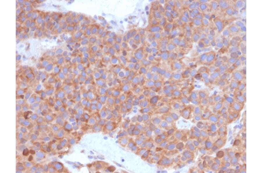 Immunohistochemistry - Anti-B7-H6 Antibody [B7H6/4821] - BSA and Azide free (A252281) - Antibodies.com