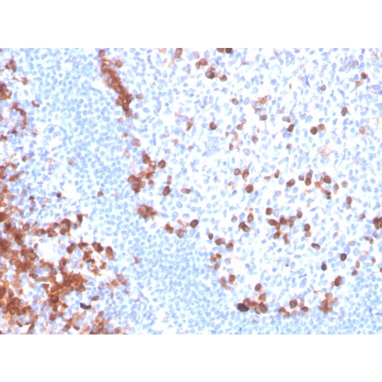 Immunohistochemistry - Anti-B7-H6 Antibody [B7H6/4821] - BSA and Azide free (A252282) - Antibodies.com