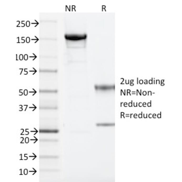 SDS-PAGE - Anti-ARF1 Antibody [1A9/5] - BSA and Azide free (A252283) - Antibodies.com