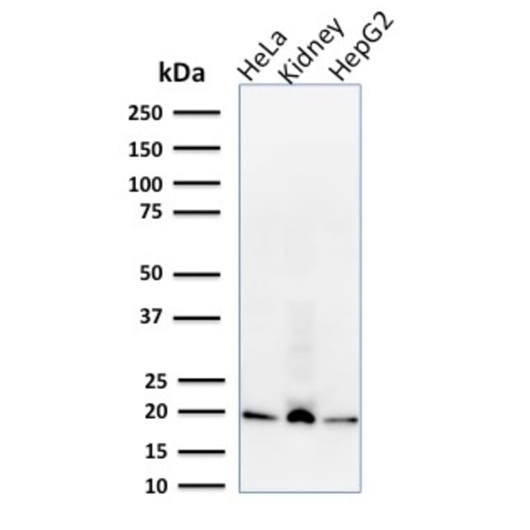 Western Blot - Anti-ARF1 Antibody [1A9/5] - BSA and Azide free (A252283) - Antibodies.com