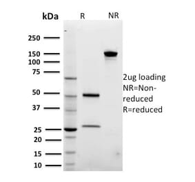 SDS-PAGE - Anti-ARF1 Antibody [3F1] - BSA and Azide free (A252283) - Antibodies.com