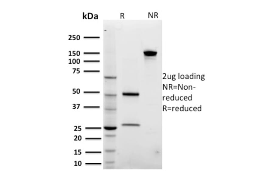 SDS-PAGE - Anti-ARF1 Antibody [3F1] - BSA and Azide free (A252283) - Antibodies.com