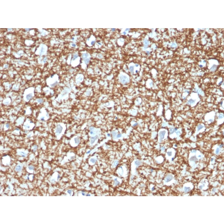 Immunohistochemistry - Anti-ARF1 Antibody [ARF1/2117] - BSA and Azide free (A252284) - Antibodies.com