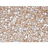 Immunohistochemistry - Anti-ARF1 Antibody [ARF1/2117] - BSA and Azide free (A252284) - Antibodies.com