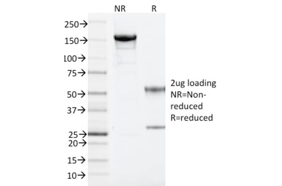 SDS-PAGE - Anti-ARF1 Antibody [ARF1/2117] - BSA and Azide free (A252285) - Antibodies.com
