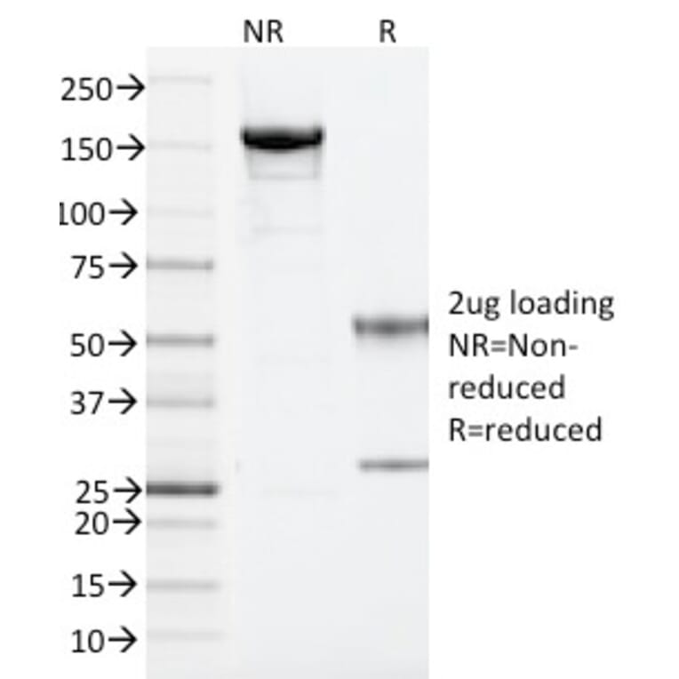 SDS-PAGE - Anti-ARF1 Antibody [ARF1/2117] - BSA and Azide free (A252285) - Antibodies.com