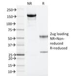 SDS-PAGE - Anti-ARF1 Antibody [ARF1/2117] - BSA and Azide free (A252285) - Antibodies.com