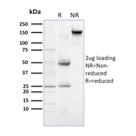 SDS-PAGE - Anti-PLK1 Antibody [AZ44] - BSA and Azide free (A252285) - Antibodies.com