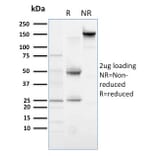 SDS-PAGE - Anti-PLK1 Antibody [AZ44] - BSA and Azide free (A252285) - Antibodies.com