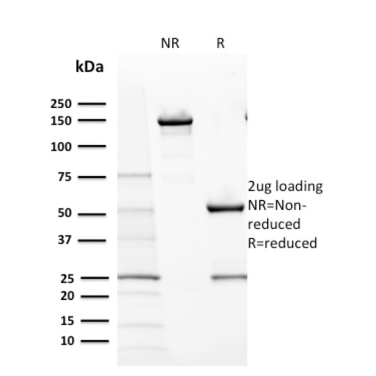 SDS-PAGE - Anti-c-Kit Antibody [KIT/2670] - BSA and Azide free (A252288) - Antibodies.com