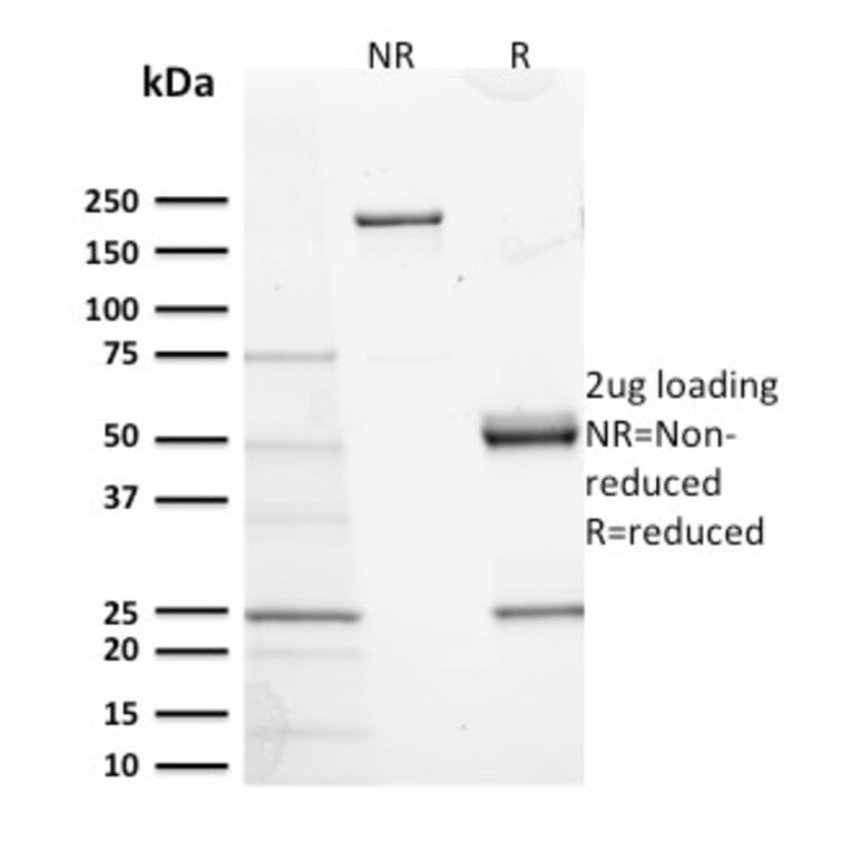 SDS-PAGE - Anti-c-Kit Antibody [KIT/2673] - BSA and Azide free (A252290) - Antibodies.com