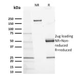 SDS-PAGE - Anti-c-Kit Antibody [KIT/2673] - BSA and Azide free (A252290) - Antibodies.com