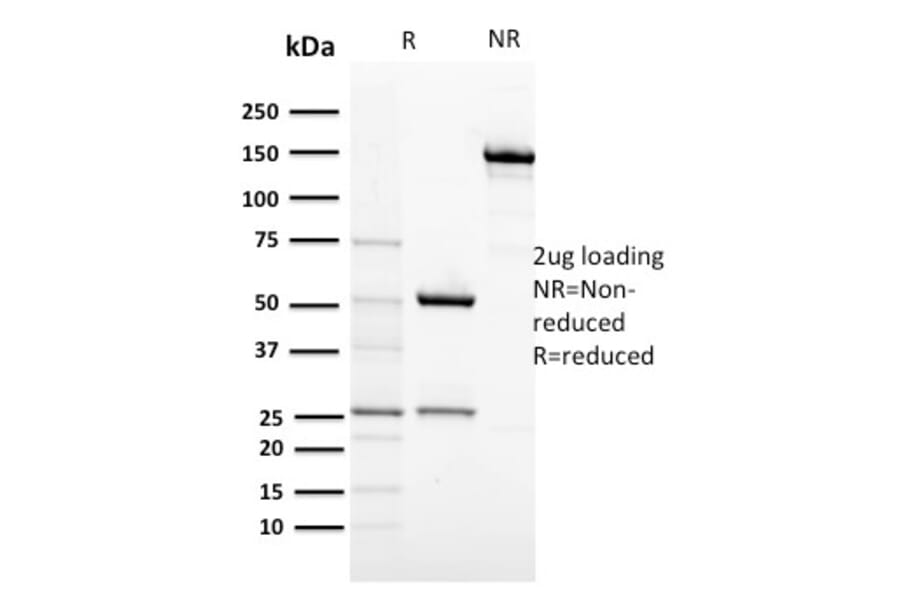 SDS-PAGE - Anti-c-Kit Antibody [KIT/2674] - BSA and Azide free (A252291) - Antibodies.com