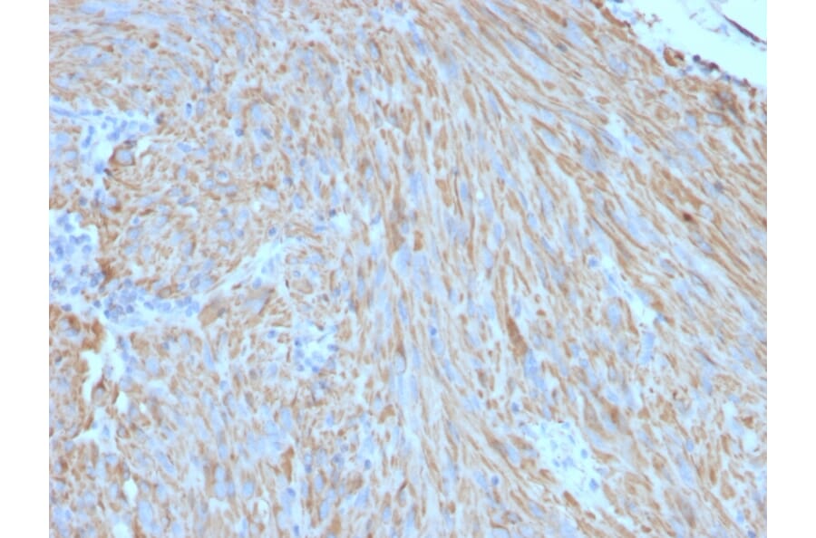 Immunohistochemistry - Anti-c-Kit Antibody [C117/370] - BSA and Azide free (A252291) - Antibodies.com