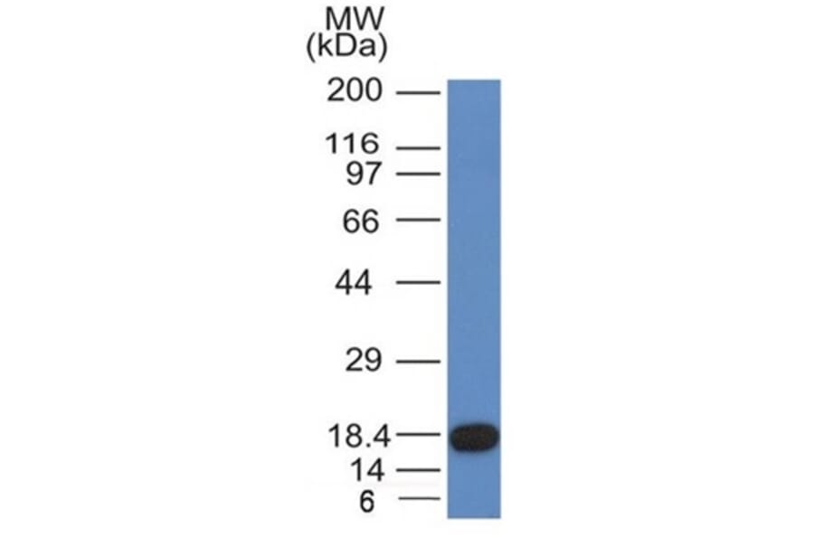 Western Blot - Anti-c-Kit Antibody [KIT/982] - BSA and Azide free (A252293) - Antibodies.com