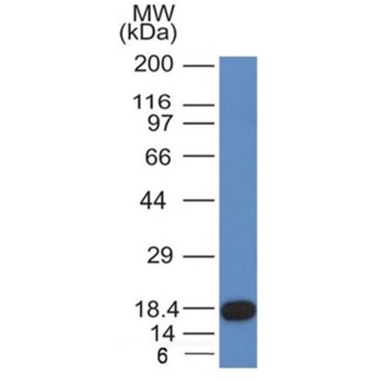 Western Blot - Anti-c-Kit Antibody [KIT/982] - BSA and Azide free (A252293) - Antibodies.com