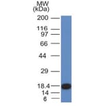 Western Blot - Anti-c-Kit Antibody [KIT/982] - BSA and Azide free (A252293) - Antibodies.com