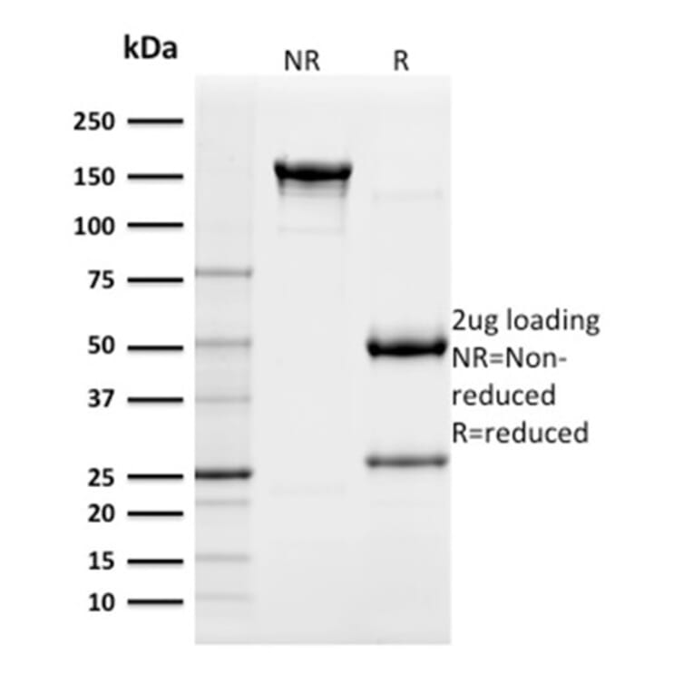SDS-PAGE - Anti-c-Kit Antibody [KIT/982] - BSA and Azide free (A252293) - Antibodies.com