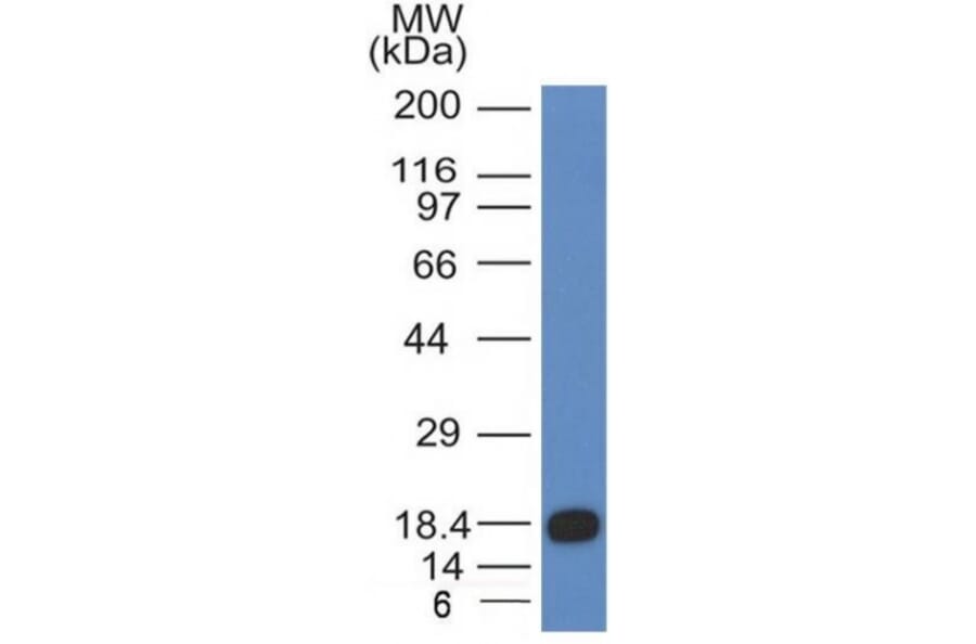 Western Blot - Anti-c-Kit Antibody [KIT/983] - BSA and Azide free (A252294) - Antibodies.com