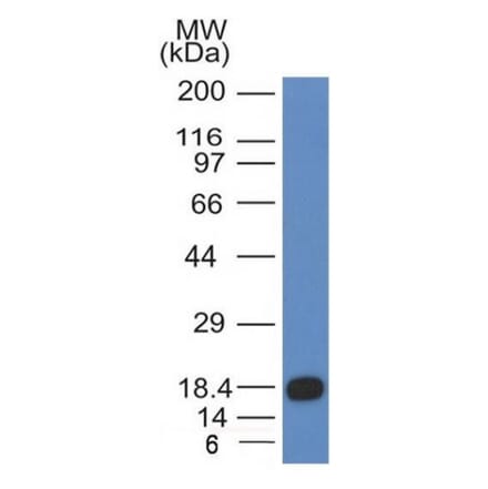 Western Blot - Anti-c-Kit Antibody [KIT/983] - BSA and Azide free (A252294) - Antibodies.com