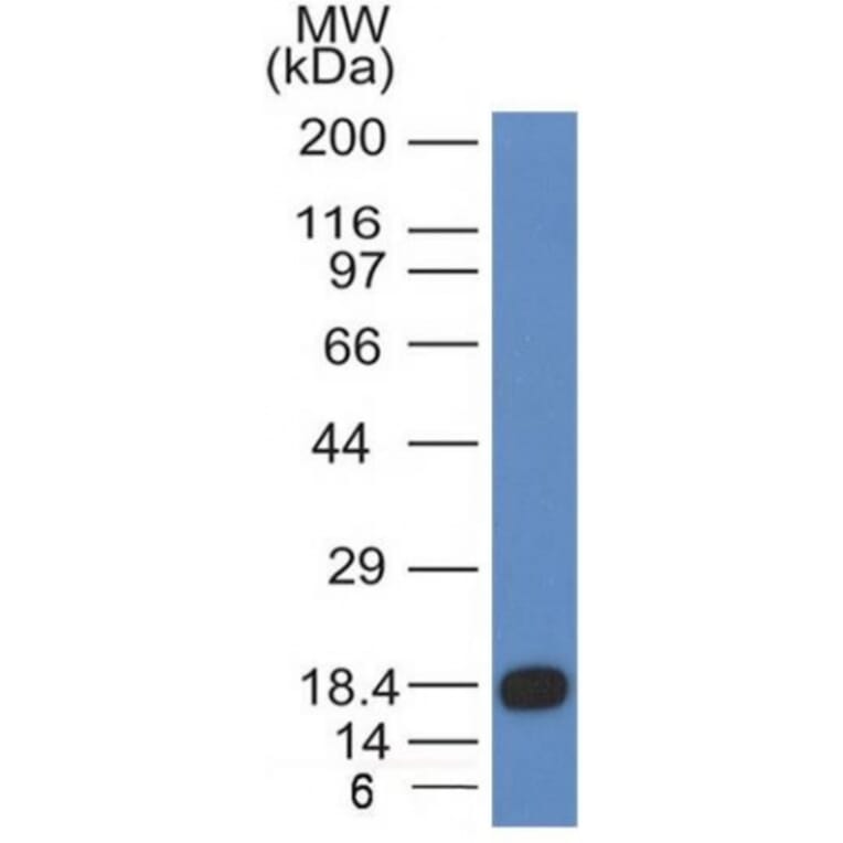 Western Blot - Anti-c-Kit Antibody [KIT/983] - BSA and Azide free (A252294) - Antibodies.com