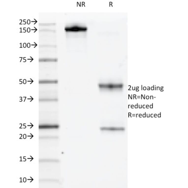 SDS-PAGE - Anti-c-Kit Antibody [KIT/983] - BSA and Azide free (A252293) - Antibodies.com