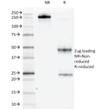 SDS-PAGE - Anti-c-Kit Antibody [KIT/983] - BSA and Azide free (A252293) - Antibodies.com