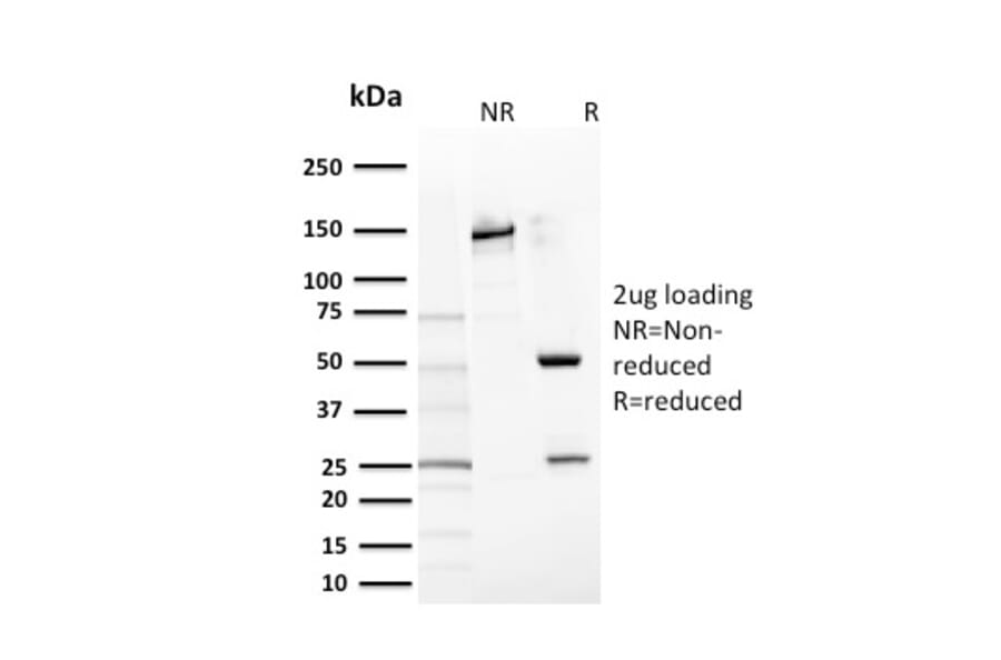 SDS-PAGE - Anti-c-Kit Antibody [KIT/2669] - BSA and Azide free (A252295) - Antibodies.com