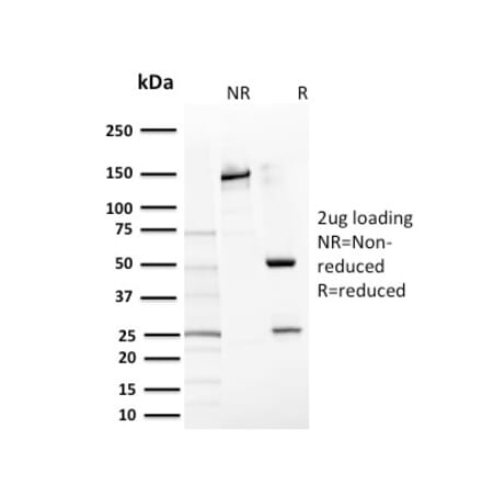 SDS-PAGE - Anti-c-Kit Antibody [KIT/2669] - BSA and Azide free (A252295) - Antibodies.com