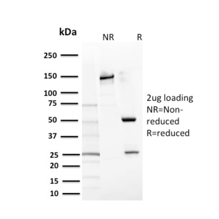 SDS-PAGE - Anti-c-Kit Antibody [KIT/2669] - BSA and Azide free (A252295) - Antibodies.com