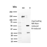 SDS-PAGE - Anti-c-Kit Antibody [KIT/2669] - BSA and Azide free (A252295) - Antibodies.com