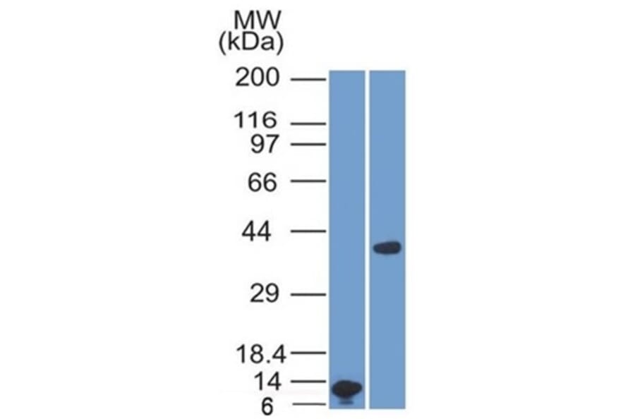 Western Blot - Anti-Arginase 1 Antibody [ARG1/1125] - BSA and Azide free (A252296) - Antibodies.com