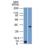 Western Blot - Anti-Arginase 1 Antibody [ARG1/1125] - BSA and Azide free (A252296) - Antibodies.com