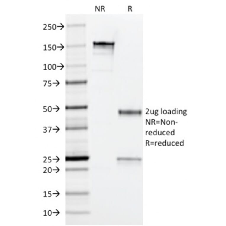SDS-PAGE - Anti-Arginase 1 Antibody [ARG1/1126] - BSA and Azide free (A252297) - Antibodies.com