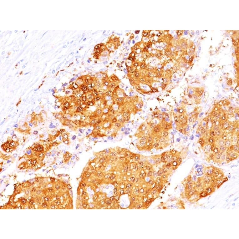 Immunohistochemistry - Anti-Arginase 1 Antibody [ARG1/1125+ ARG1/1126] - BSA and Azide free (A252298) - Antibodies.com