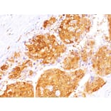 Immunohistochemistry - Anti-Arginase 1 Antibody [ARG1/1125+ ARG1/1126] - BSA and Azide free (A252298) - Antibodies.com