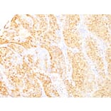 Immunohistochemistry - Anti-Arginase 1 Antibody [ARG1/1125+ ARG1/1126] - BSA and Azide free (A252297) - Antibodies.com