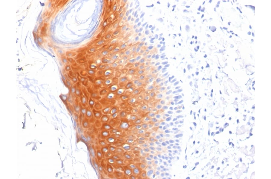 Immunohistochemistry - Anti-Cytokeratin 1 Antibody [LHK1] - BSA and Azide free (A252299) - Antibodies.com
