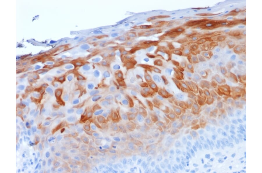 Immunohistochemistry - Anti-Cytokeratin 1 Antibody [LHK1] - BSA and Azide free (A252298) - Antibodies.com