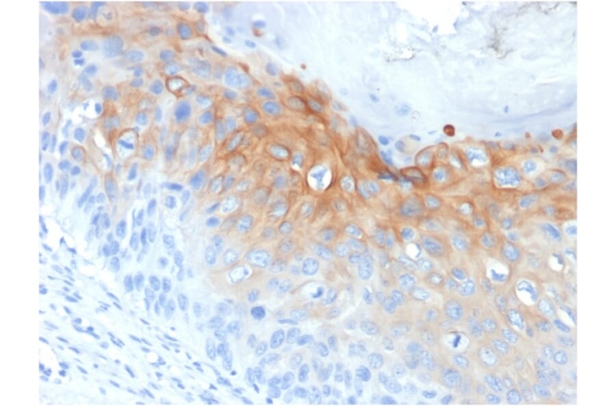 Immunohistochemistry - Anti-Cytokeratin 1 Antibody [KRT1/1840] - BSA and Azide free (A252299) - Antibodies.com